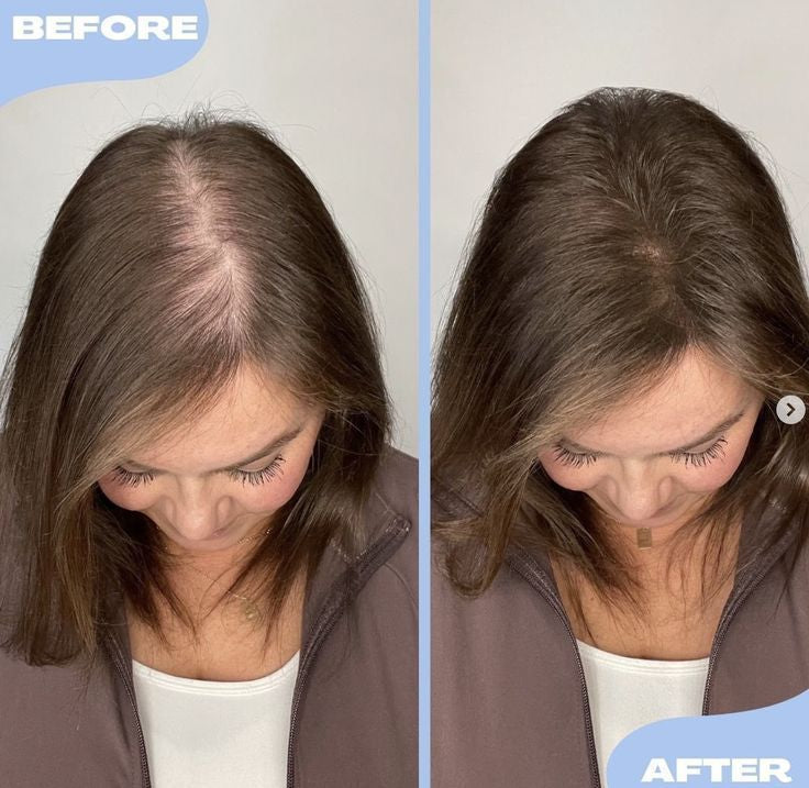 REVITALIZZA® Serum Roll-On — Regrow Every Inch — Real, Visible Hair Growth Across Your Scalp in Just 12 Weeks