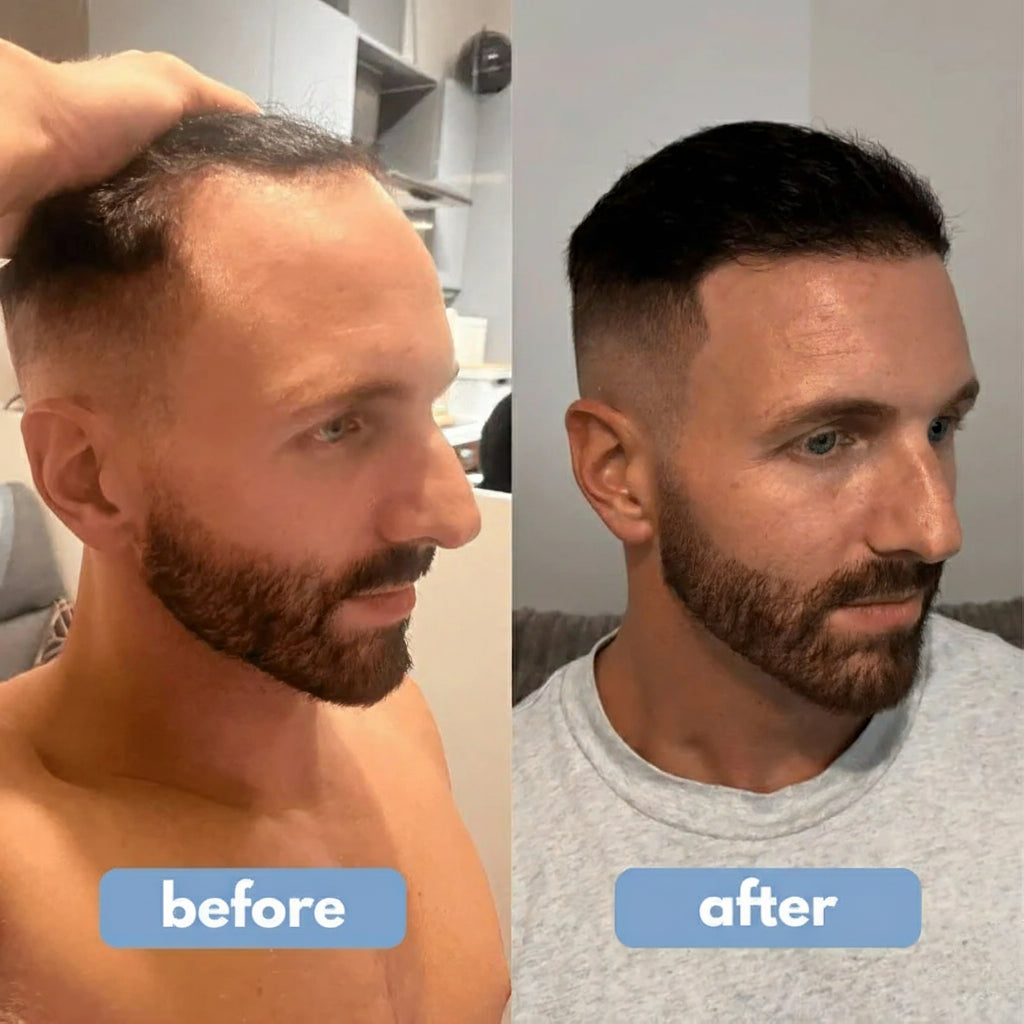 REVITALIZZA® Serum Roll-On — Regrow Every Inch — Real, Visible Hair Growth Across Your Scalp in Just 12 Weeks