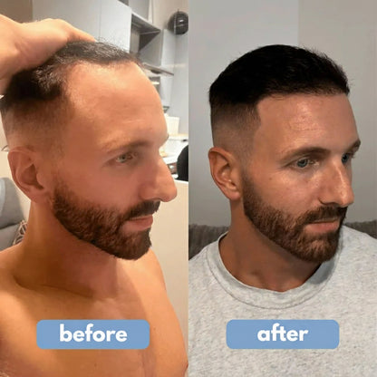 REVITALIZZA® Serum Roll-On — Regrow Every Inch — Real, Visible Hair Growth Across Your Scalp in Just 12 Weeks